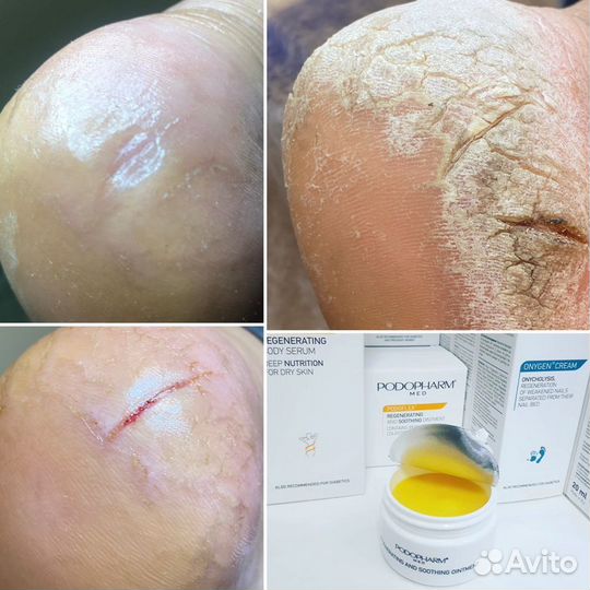 Подолог Феодосия