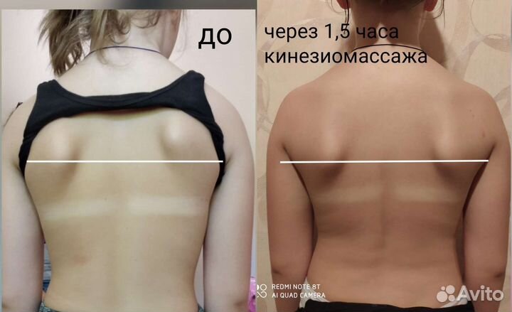 Кинезиолог, массажист, тейпирование