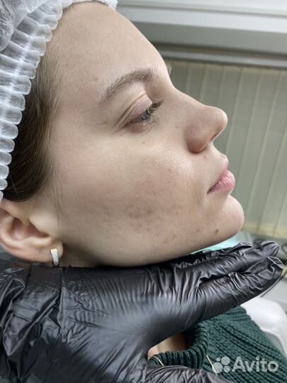 Ресницы, косметология, перманент