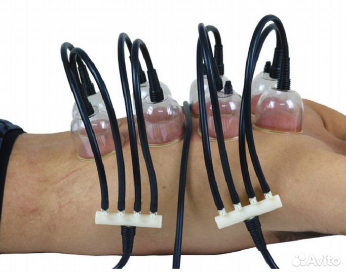 Набор вакуумных банок