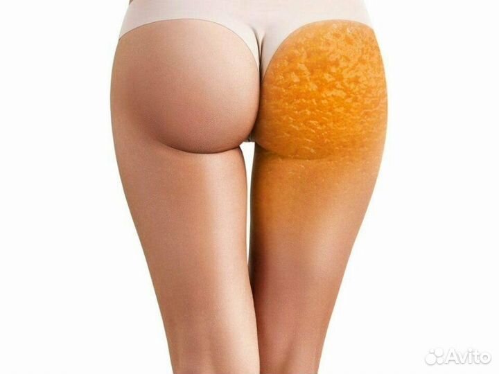 LPG-массаж/Аппаратная косметология/RF-лифтинг