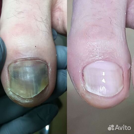 Подолог Алтуфьево Бибирево свао