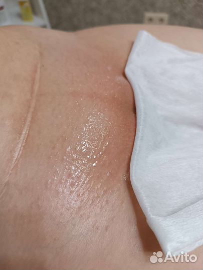 Депиляция шугаринг