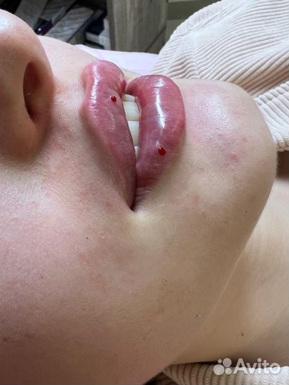 Косметология модели