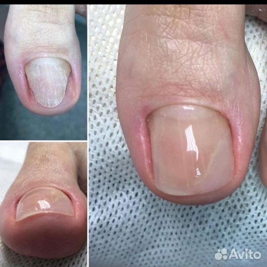 Маникюр Педикюр любой сложности Подолог
