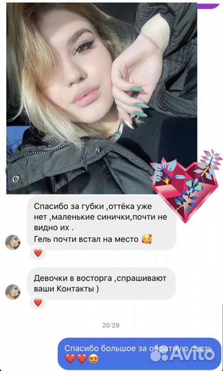 Увеличение губ