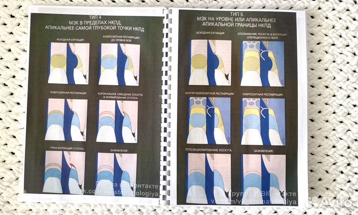 Пластическая хирургия мягких тканей полости рта