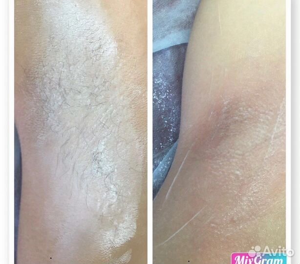 Мастер по шугарингу