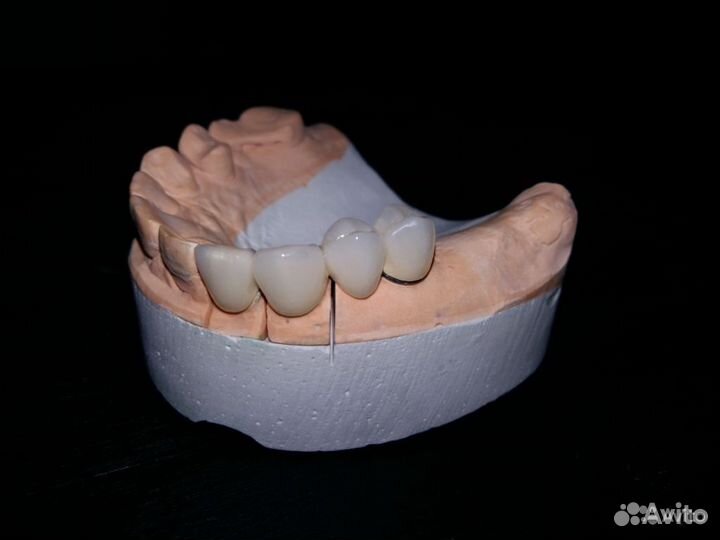 Съемные Несъемные Зубные протезы Виниры