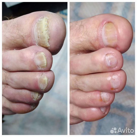 Педикюр с выездом на дом