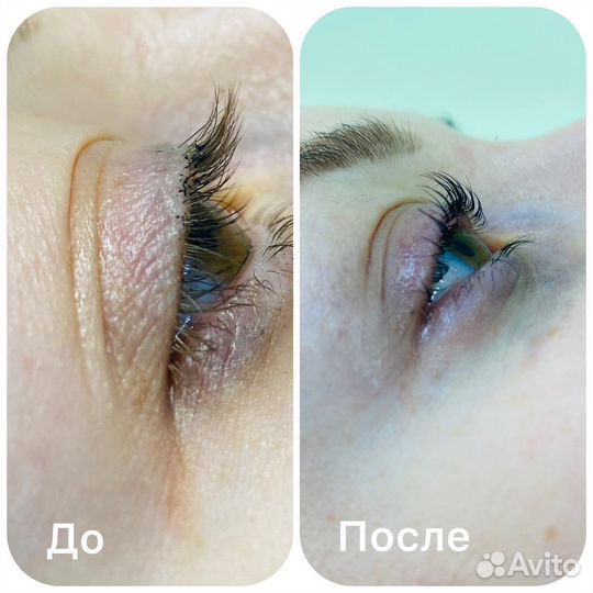 Стрейчинг ресниц