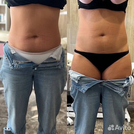 Косметолог, чистка лица, пилинг,омоложение