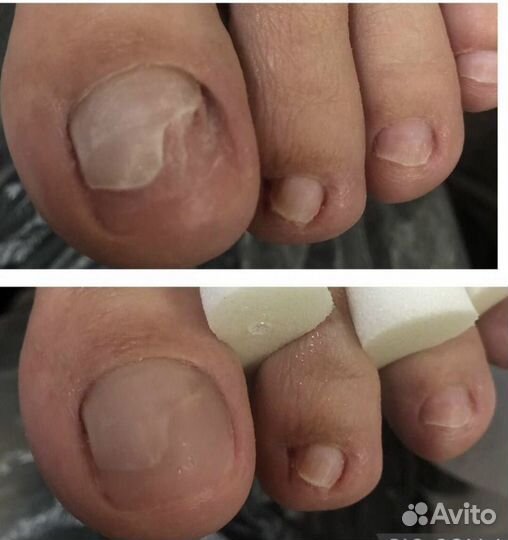 Услуги подолога