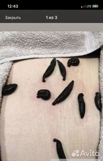 Пиявки медицинские аптечные