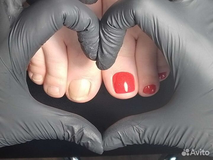 Подолог Педикюр