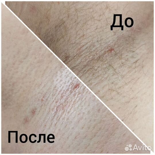 Мастер шугаринга и депиляции