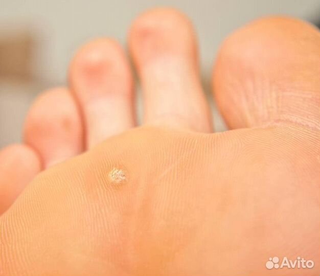 Требуется модели на курсы по подологии