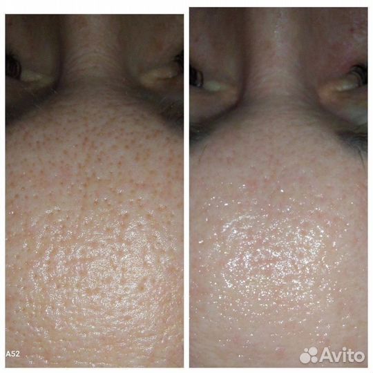 Косметик-эстетист, коррекция фигуры