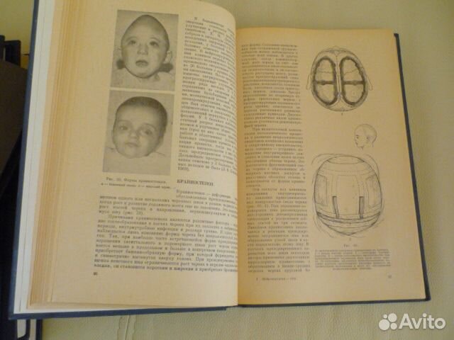 И. М. Иргер Нейрохирургия