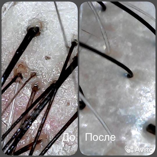 Трихолог-эстетист/технолог/реконструкция волос