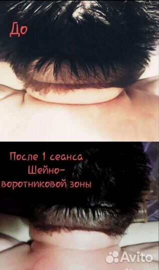 Профессиональный Массаж и Коррекция фигуры