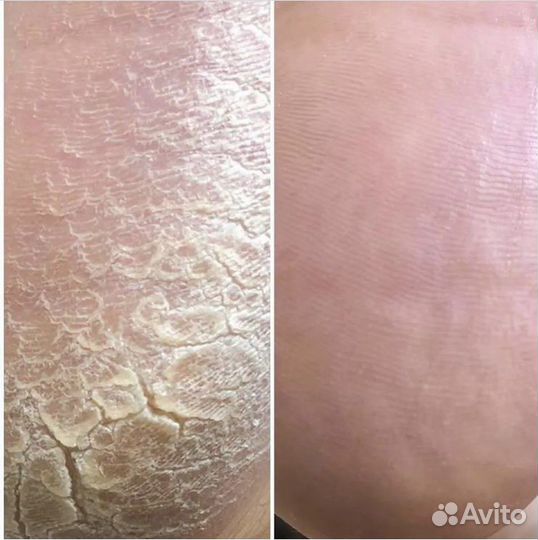 Подолог (педикюр)