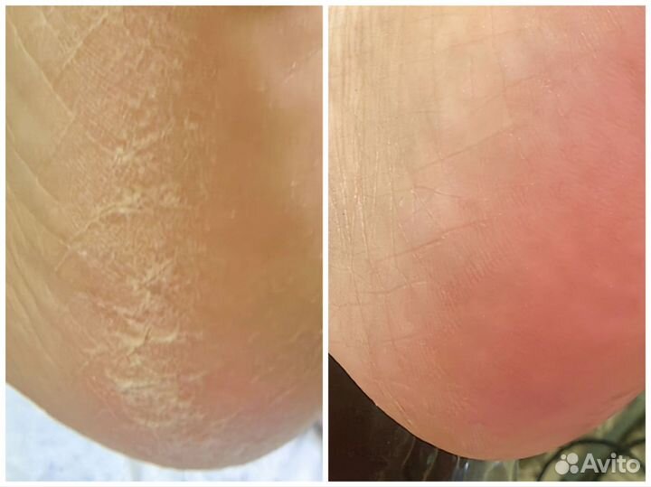 Модель маникюр/педикюр подология