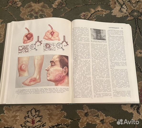 Бмэ Большая медицинская энциклопедия