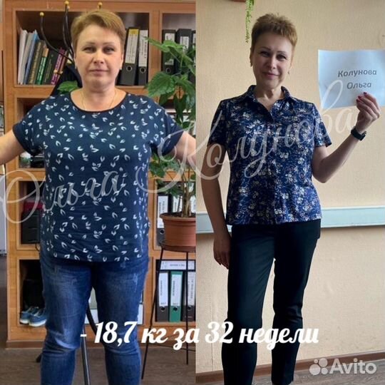 Похудеть на 10 кг, Диетолог, Похудение, Целлюлит