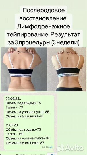 Тейпирование эстетическое и терапевтическое