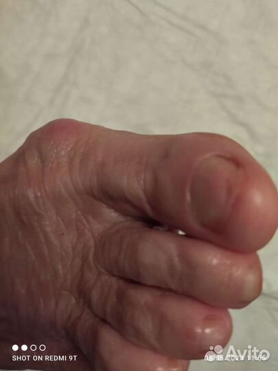 Подолог, лечебный педикюр с выездом на дом