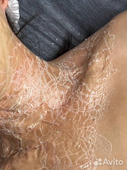 Уход Ферментотерапия мать невесты DMK