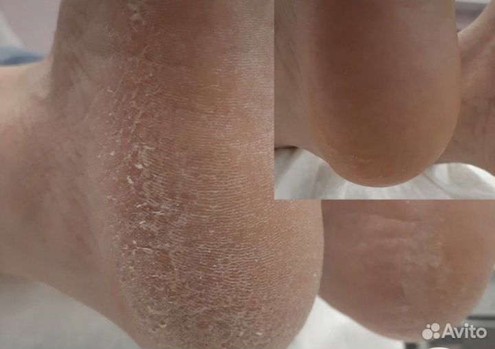 Подолог с медицинским образованием