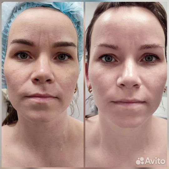 Косметолог с высшим медицинским