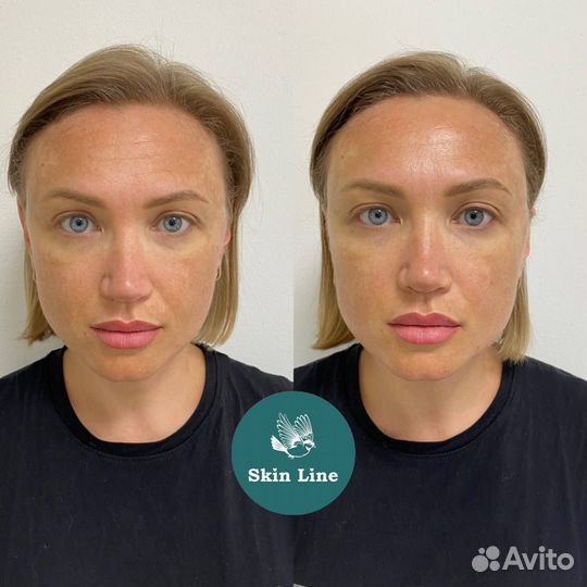 Модели / микротоки / омолаживание