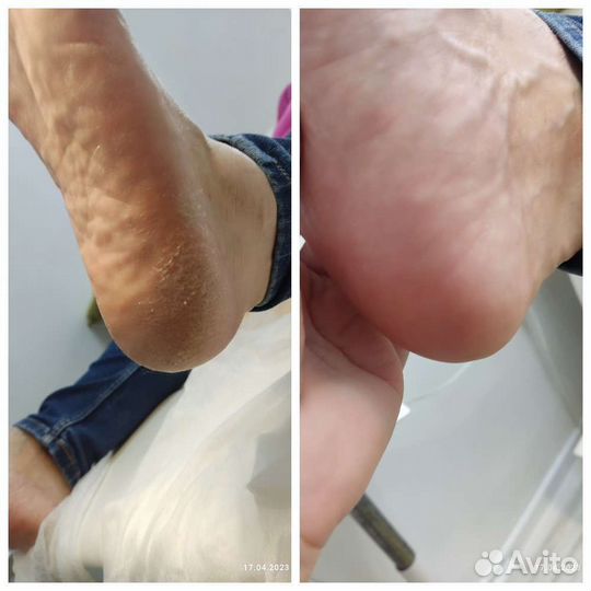 Маникюр педикюр