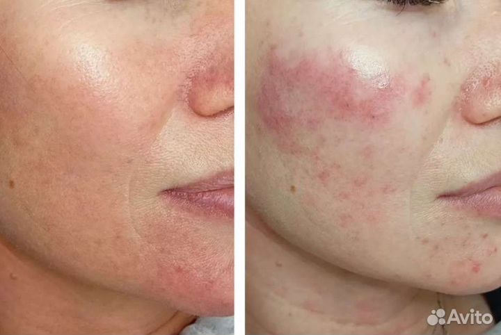 Услуги косметолога