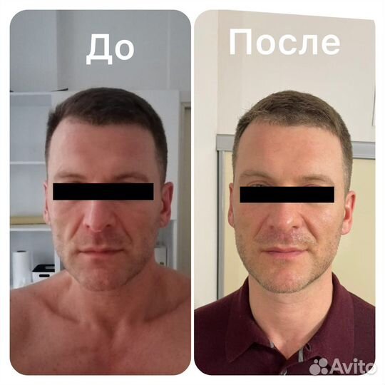 Японский массаж лица