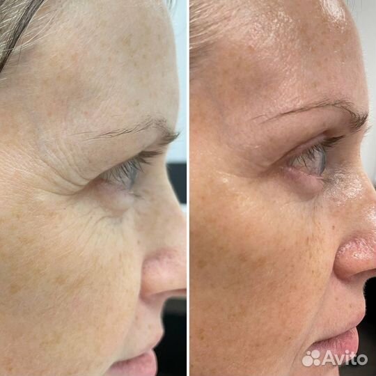 Подарочный набор уходовой косметики Atomy