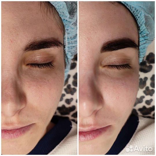 Косметолог с высшим медицинским