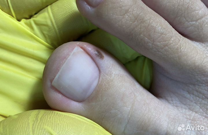 Подолог педикюр подология