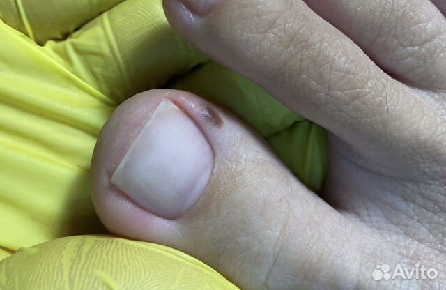 Подолог педикюр подология