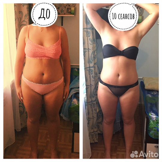 Массаж/ аппаратные процедуры