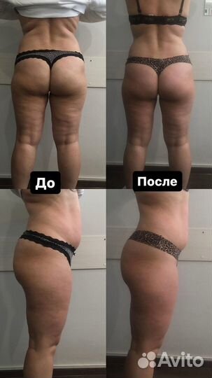 Массаж лица и тела