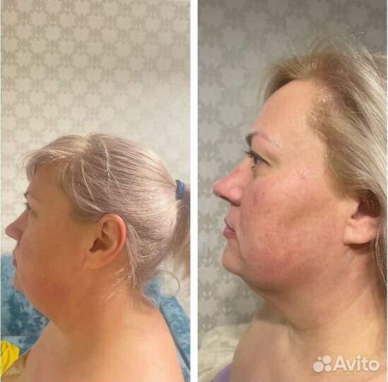 Массаж лица