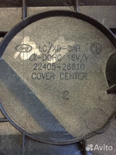 Накладка на двигатель декоративная Hyundai Matrix