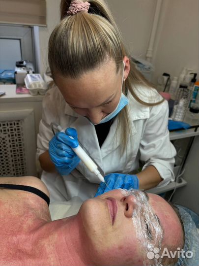 Услуги косметолога холодная плазма