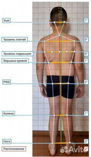 Студия осанки, online тестирование