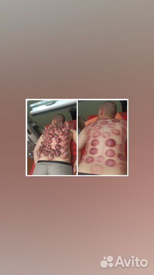 Массаж на дому