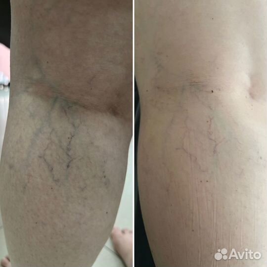 Водоросли ламинария и фукус